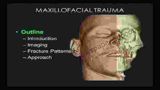 Case Studies In Facial Trauma Essentials Of Craniomaxillofacial Trauma Graham Dale