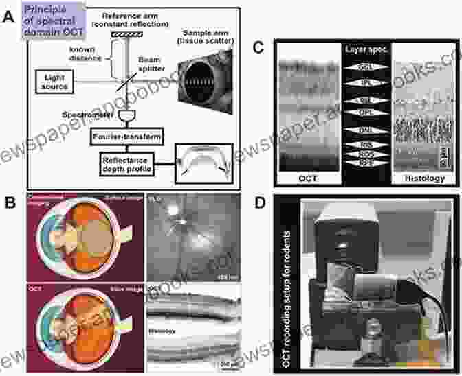 Schematic Diagram Illustrating The Principles Of Optical Coherence Tomography Optical Coherence Tomography Of Ocular Diseases: Third Edition