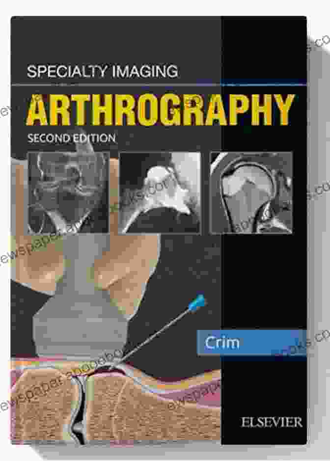 Specialty Imaging Arthrography Book Cover Featuring An X Ray Image Of A Joint Specialty Imaging: Arthrography Guy Jackson