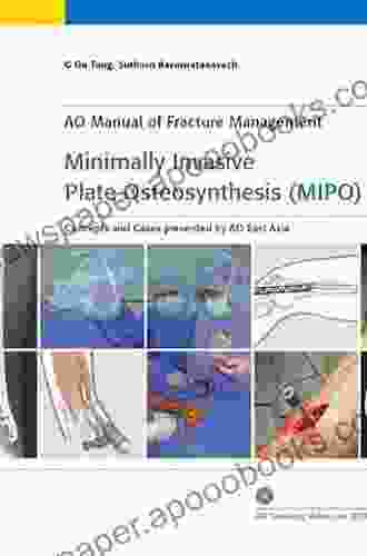 Minimally Invasive Plate Osteosynthesis (MIPO) (AO Publishing)