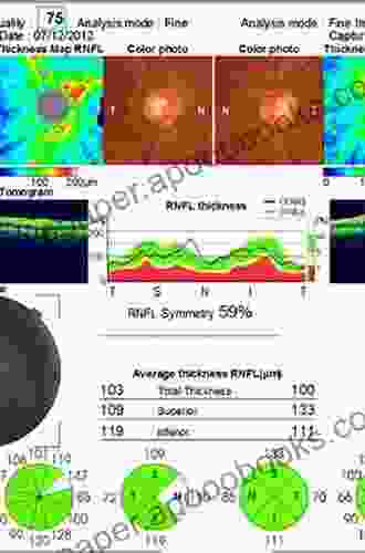 Optical Coherence Tomography of Ocular Diseases: Third Edition