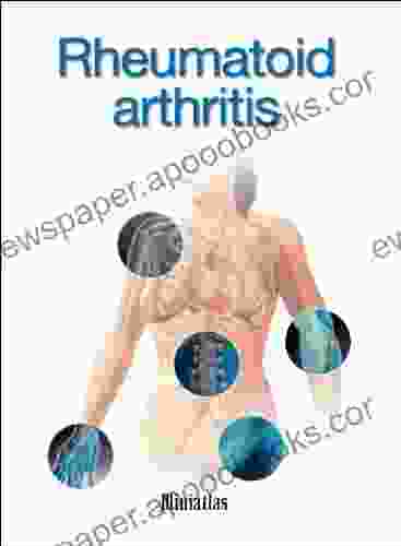 Rheumatoid Arthritis Miniatlas Glenn N Levine