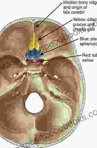 Midline Skull Base Surgery James Edward