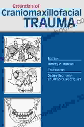 Essentials of Craniomaxillofacial Trauma Graham Dale